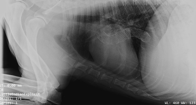 Röntgenbild nach 2 Wochen zeigt stabile Position des Stents