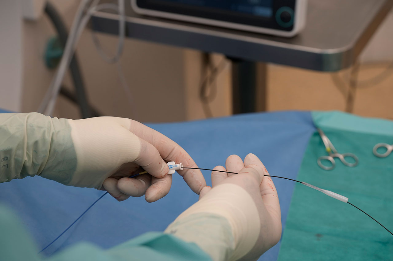 Katheter und Drähte