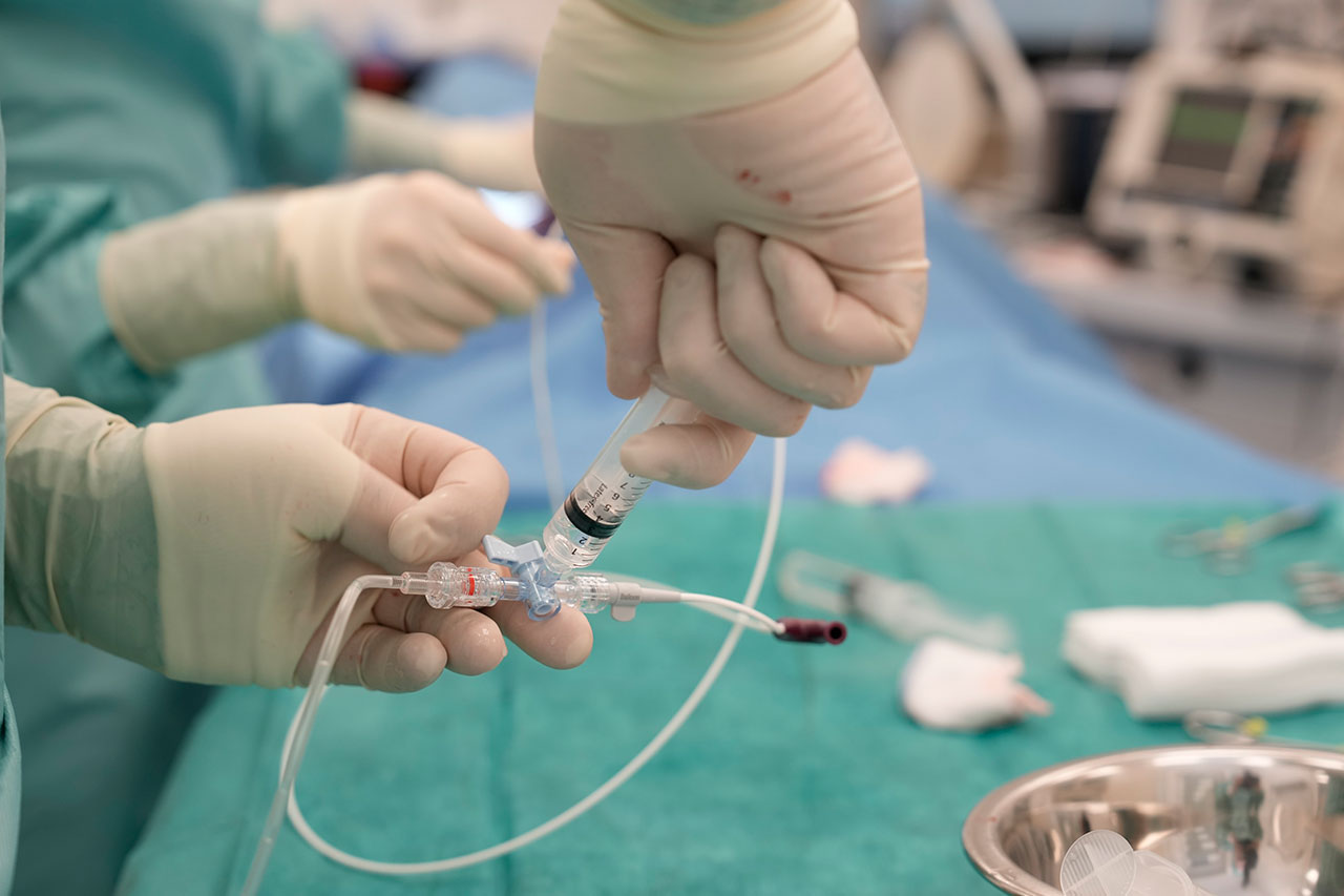 Vorbereitung des Ballonkatheters