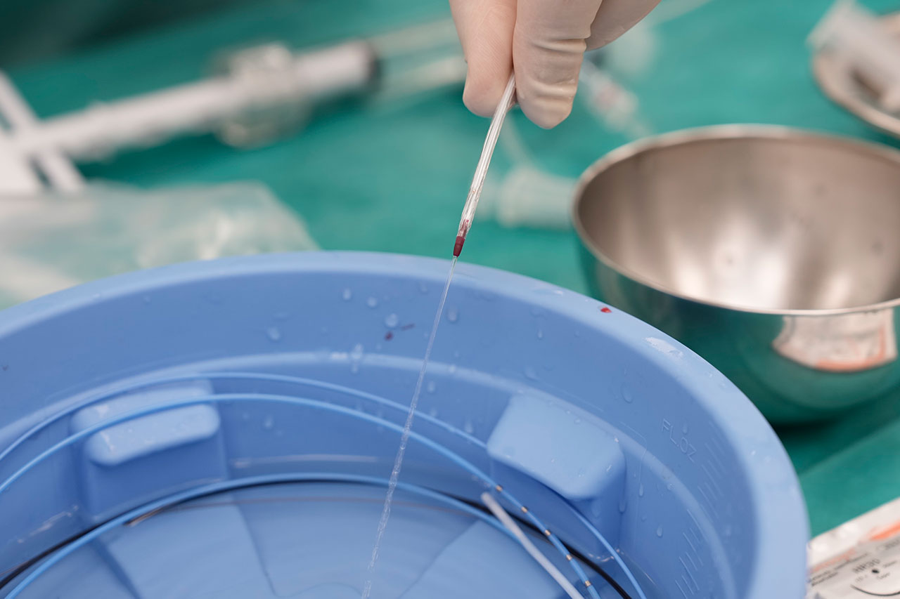 Vorbereitung des Ballonkatheters