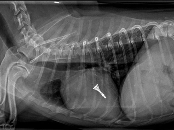 Thoraxröntgenaufnahme in latero-lateraler Projektion. V-Clamp ist in situ darstellbar.